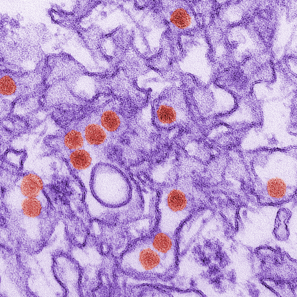 Zika virus under microscope